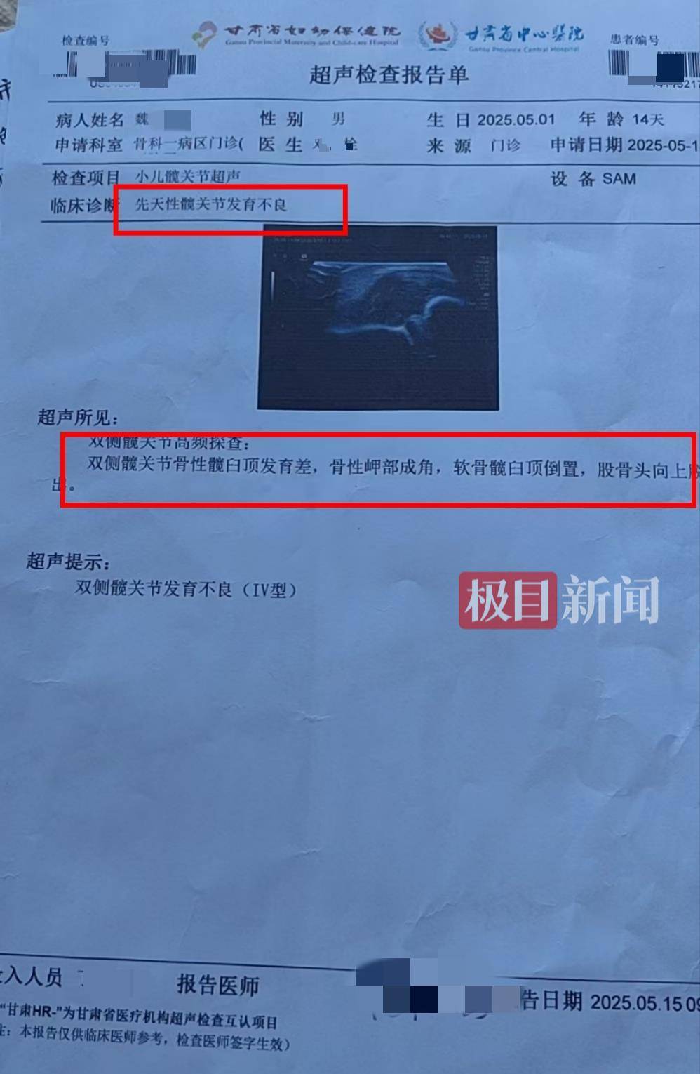 二胎出生查出先天性病症或落下残疾<strong></p>
<p>重生之金融巨擘</strong>，残疾父母称医院产检漏检、未尽告知义务，医院及医调委回应