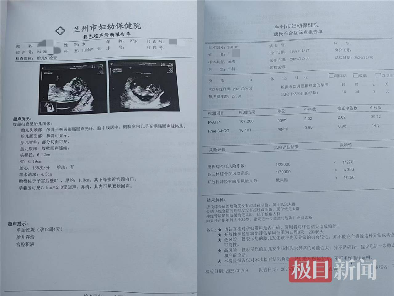 二胎出生查出先天性病症或落下残疾<strong></p>
<p>重生之金融巨擘</strong>，残疾父母称医院产检漏检、未尽告知义务，医院及医调委回应