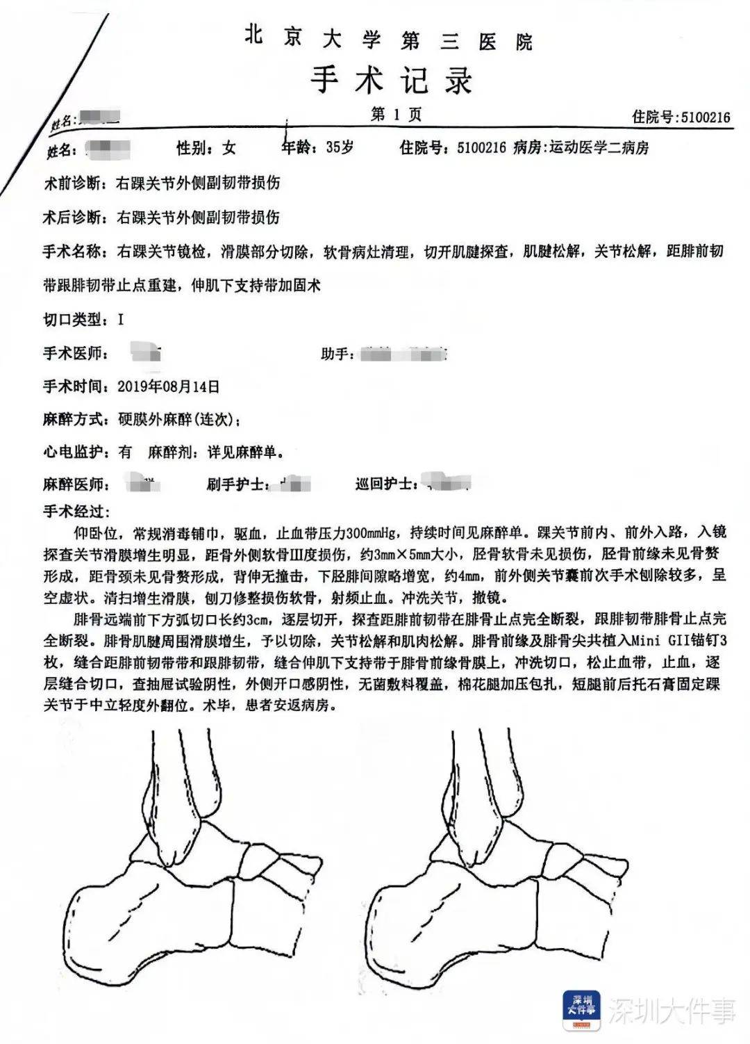 “一走路就痛”！女子脚踝受伤遭漏诊<strong></p>
<p>金融经济</strong>，治了7年没好！深圳一医院被告上法庭
