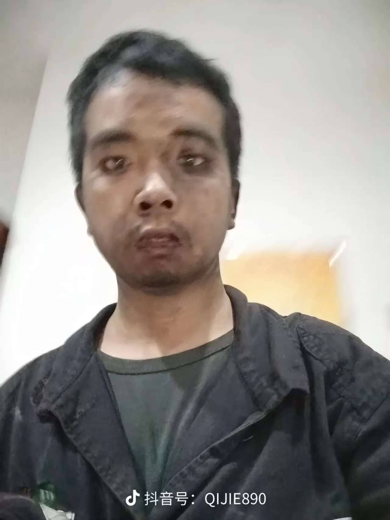 挖煤小伙回应逆袭成北工大博士：迷茫和焦虑没有用<strong></p>
<p>买入返售金融资产</strong>，做事情要果断、坚决、讲策略