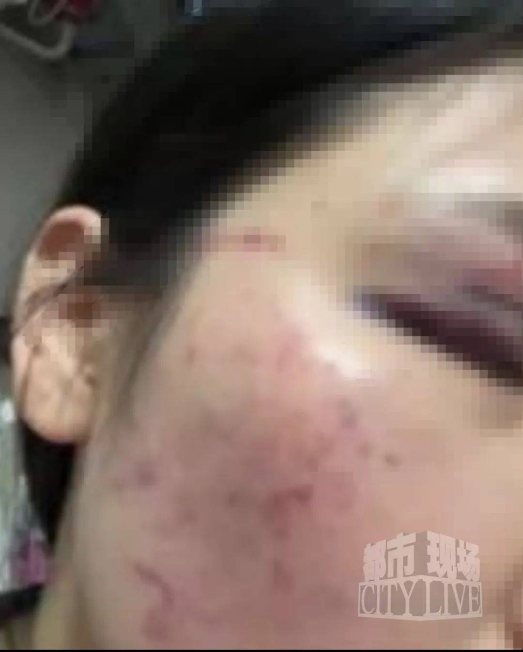湖南衡阳29岁女子疑被男友施暴后从25楼跳下身亡 男友徐某此前还刺激说：“你放心<strong></p>
<p>五粮液股票</strong>，她不会去死的”
