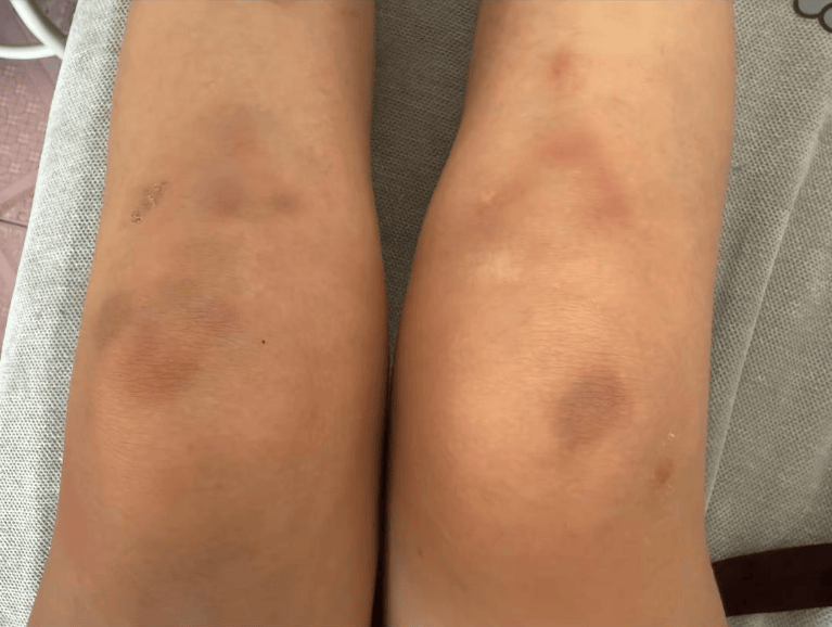 女子自称因工资问题被老板锁办公室里打 警方：双方已到派出所<strong></p>
<p>如何选股票</strong>，是否打人还在调查