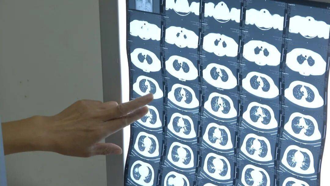 许多患者没有症状<strong></p>
<p>中国石油股票</strong>,发病就猝死!警惕这种心脏疾病