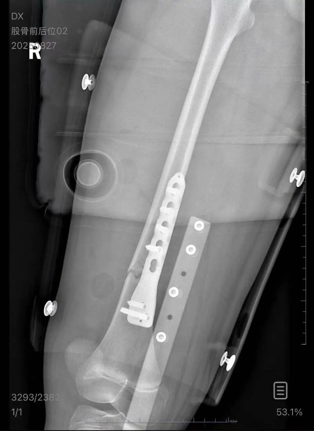 男子火车上铺跌落砸断10岁女孩腿骨<strong></p>
<p>京东方a股票</strong>，回应“失联”称失业讨薪中