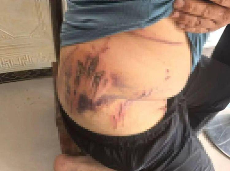 湖北鹤峰县疑再现老虎踪迹<strong></p>
<p>紫金矿业股票</strong>，村民家猪遭袭，玉米地发现脚印，此前男子自称干农活时被抓伤，当地回应