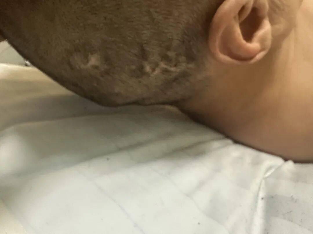 4名游客景区内遭马蜂袭击，旅游度假区：是森林公园不卖门票，蜇伤先就医后提供证据投诉