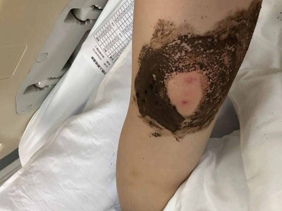 4名游客景区内遭马蜂袭击<strong></p>
<p>方正科技股票</strong>，旅游度假区：是森林公园不卖门票，蜇伤先就医后提供证据投诉