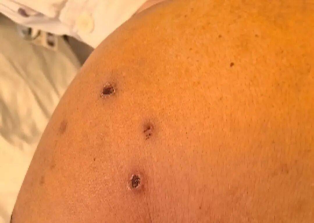 深圳一市民突遭马蜂围袭！已进入高发期<strong></p>
<p>方正科技股票</strong>，千万别招惹！